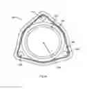 Fig. 31 - Robotic catheter system and methods