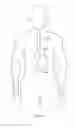 Fig. 310 - Robotic catheter system and methods