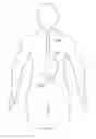 Fig. 313 - Robotic catheter system and methods