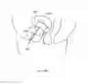 Fig. 320 - Robotic catheter system and methods