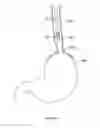 Fig. 323 - Robotic catheter system and methods