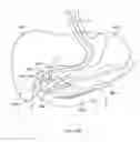 Fig. 332 - Robotic catheter system and methods