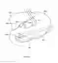 Fig. 337 - Robotic catheter system and methods