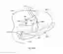 Fig. 341 - Robotic catheter system and methods