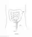 Fig. 342 - Robotic catheter system and methods
