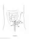 Fig. 345 - Robotic catheter system and methods
