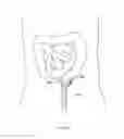 Fig. 347 - Robotic catheter system and methods