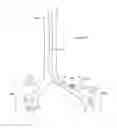Fig. 355 - Robotic catheter system and methods