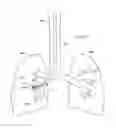 Fig. 358 - Robotic catheter system and methods