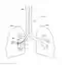 Fig. 359 - Robotic catheter system and methods
