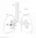 Fig. 360 - Robotic catheter system and methods