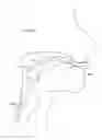 Fig. 368 - Robotic catheter system and methods