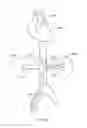 Fig. 374 - Robotic catheter system and methods