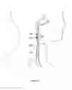 Fig. 385 - Robotic catheter system and methods