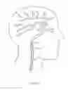 Fig. 387 - Robotic catheter system and methods