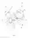 Fig. 76 - Robotic catheter system and methods