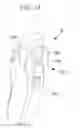 Fig. 14 - Surgical-manipulator operating device and surgical-manipulator system