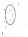 Fig. 08 - Wound closure product