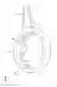 Fig. 13 - Wound closure product