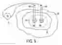 Fig. 06 - Needle probe guide