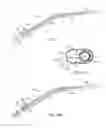 Fig. 02 - ILLUMINATED SUCTION APPARATUS