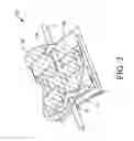 Fig. 03 - ORTHODONTIC LIGATURE