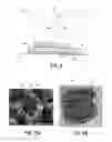 Fig. 03 - PADS FOR ORTHODONTIC BRACKETS, ORTHODONTIC BRACKETS, AND METHODS OF MAKING ORTHODONTIC BRACKETS