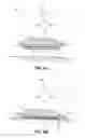 Fig. 05 - PADS FOR ORTHODONTIC BRACKETS, ORTHODONTIC BRACKETS, AND METHODS OF MAKING ORTHODONTIC BRACKETS
