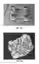 Fig. 06 - PADS FOR ORTHODONTIC BRACKETS, ORTHODONTIC BRACKETS, AND METHODS OF MAKING ORTHODONTIC BRACKETS