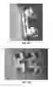 Fig. 07 - PADS FOR ORTHODONTIC BRACKETS, ORTHODONTIC BRACKETS, AND METHODS OF MAKING ORTHODONTIC BRACKETS