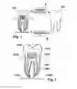 Fig. 02 - Methods of designing and manufacturing customized dental prosthesis for periodontal or osseointegration and related systems