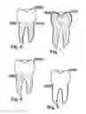 Fig. 06 - Methods of designing and manufacturing customized dental prosthesis for periodontal or osseointegration and related systems