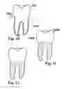 Fig. 07 - Methods of designing and manufacturing customized dental prosthesis for periodontal or osseointegration and related systems
