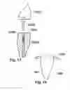 Fig. 08 - Methods of designing and manufacturing customized dental prosthesis for periodontal or osseointegration and related systems