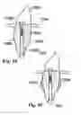 Fig. 09 - Methods of designing and manufacturing customized dental prosthesis for periodontal or osseointegration and related systems