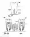 Fig. 10 - Methods of designing and manufacturing customized dental prosthesis for periodontal or osseointegration and related systems