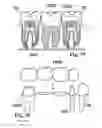 Fig. 11 - Methods of designing and manufacturing customized dental prosthesis for periodontal or osseointegration and related systems