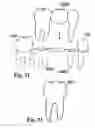 Fig. 12 - Methods of designing and manufacturing customized dental prosthesis for periodontal or osseointegration and related systems
