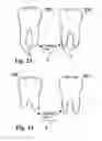 Fig. 13 - Methods of designing and manufacturing customized dental prosthesis for periodontal or osseointegration and related systems