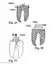 Fig. 16 - Methods of designing and manufacturing customized dental prosthesis for periodontal or osseointegration and related systems