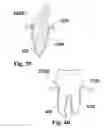 Fig. 20 - Methods of designing and manufacturing customized dental prosthesis for periodontal or osseointegration and related systems