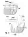 Fig. 22 - Methods of designing and manufacturing customized dental prosthesis for periodontal or osseointegration and related systems