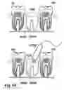 Fig. 27 - Methods of designing and manufacturing customized dental prosthesis for periodontal or osseointegration and related systems