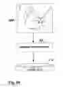 Fig. 29 - Methods of designing and manufacturing customized dental prosthesis for periodontal or osseointegration and related systems