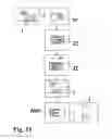 Fig. 30 - Methods of designing and manufacturing customized dental prosthesis for periodontal or osseointegration and related systems