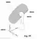 Fig. 34 - Methods of designing and manufacturing customized dental prosthesis for periodontal or osseointegration and related systems