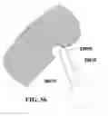 Fig. 35 - Methods of designing and manufacturing customized dental prosthesis for periodontal or osseointegration and related systems