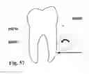 Fig. 36 - Methods of designing and manufacturing customized dental prosthesis for periodontal or osseointegration and related systems