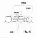 Fig. 38 - Methods of designing and manufacturing customized dental prosthesis for periodontal or osseointegration and related systems