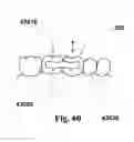 Fig. 39 - Methods of designing and manufacturing customized dental prosthesis for periodontal or osseointegration and related systems